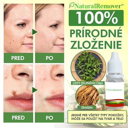 NaturalRemover™ Odstraňovač Bradavíc