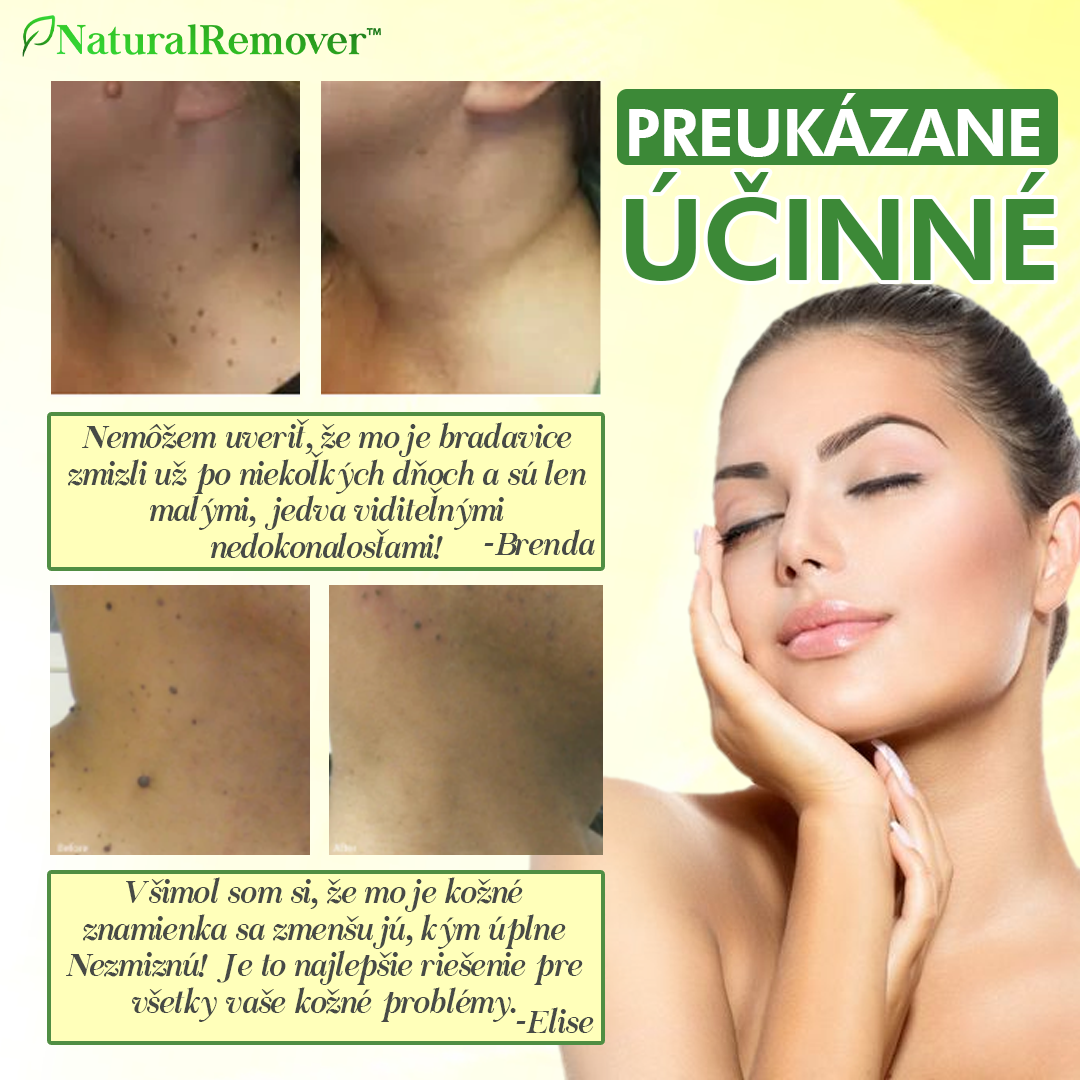 NaturalRemover™ Odstraňovač Bradavíc