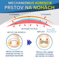 ToePerfect™ Korekcia Prstov